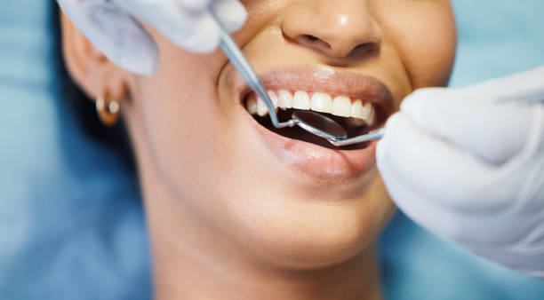 Best Emergency Dental Care for Sports Injuries in North Branch, MN