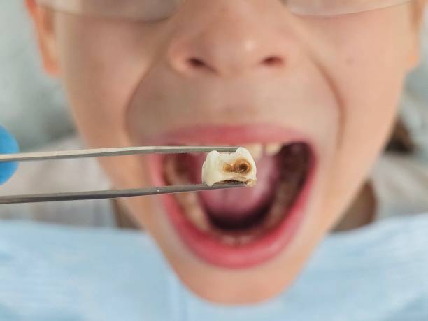 Best Walk-In Emergency Dental Services in North Branch, MN