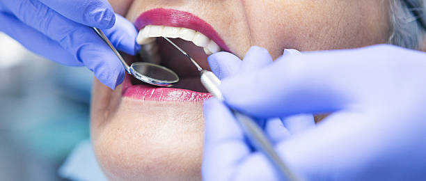 Best Emergency Care for Gum Disease in North Branch, MN